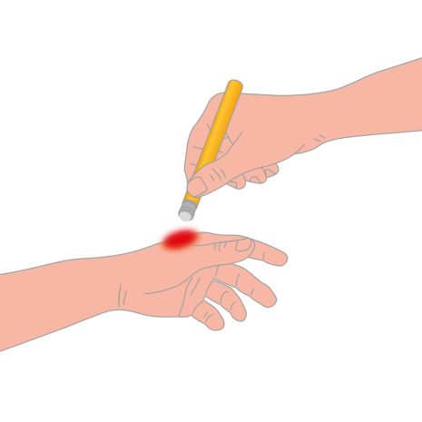 AFTER BITE ΓΙΑ ΜΕΤΑ ΤΟ ΤΣΙΜΠΗΜΑ ΣΤΙΚ 16ml Auto Moto Tyres 